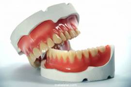 Diş Protezi ve Diş Protez Çeşitleri