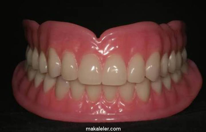 Tam Diş Protezi Nedir, Hangi Hastalara Uygulanır?